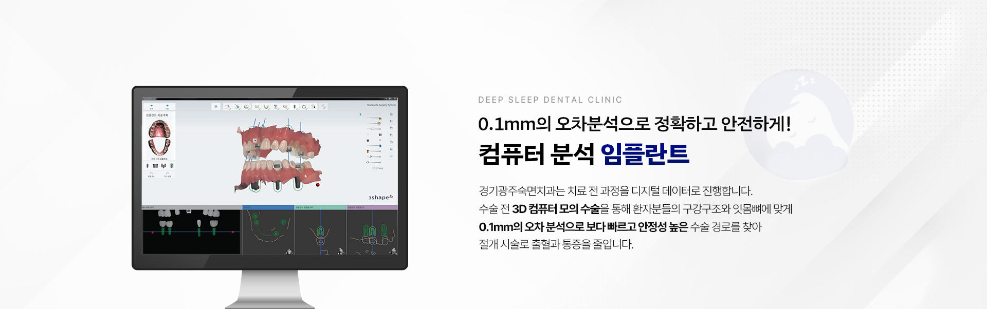 0.1mm의 오차분석으로 정확하고 안전하게! 컴퓨터 분석 임플란트