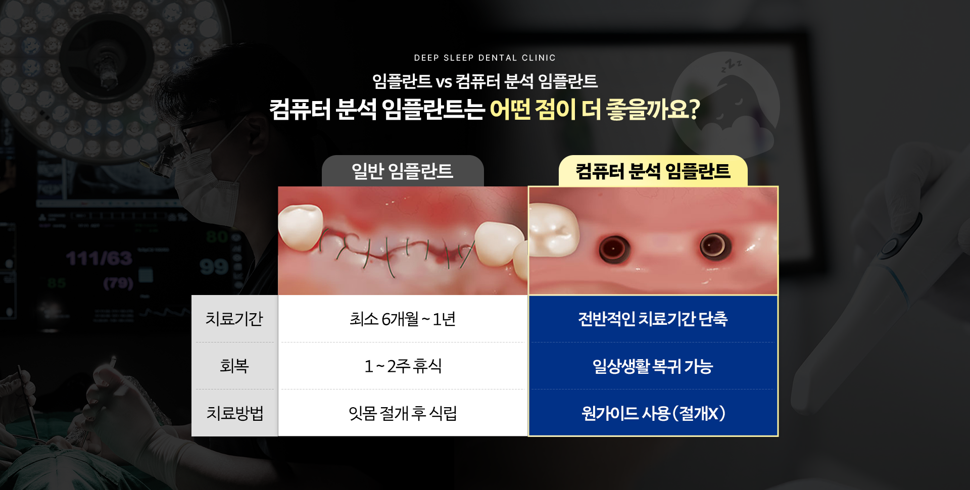 임플란트 vs 컴퓨터 분석 임플란트 컴퓨터 분석 임플란트는 어떤 점이 더 좋을까요?
