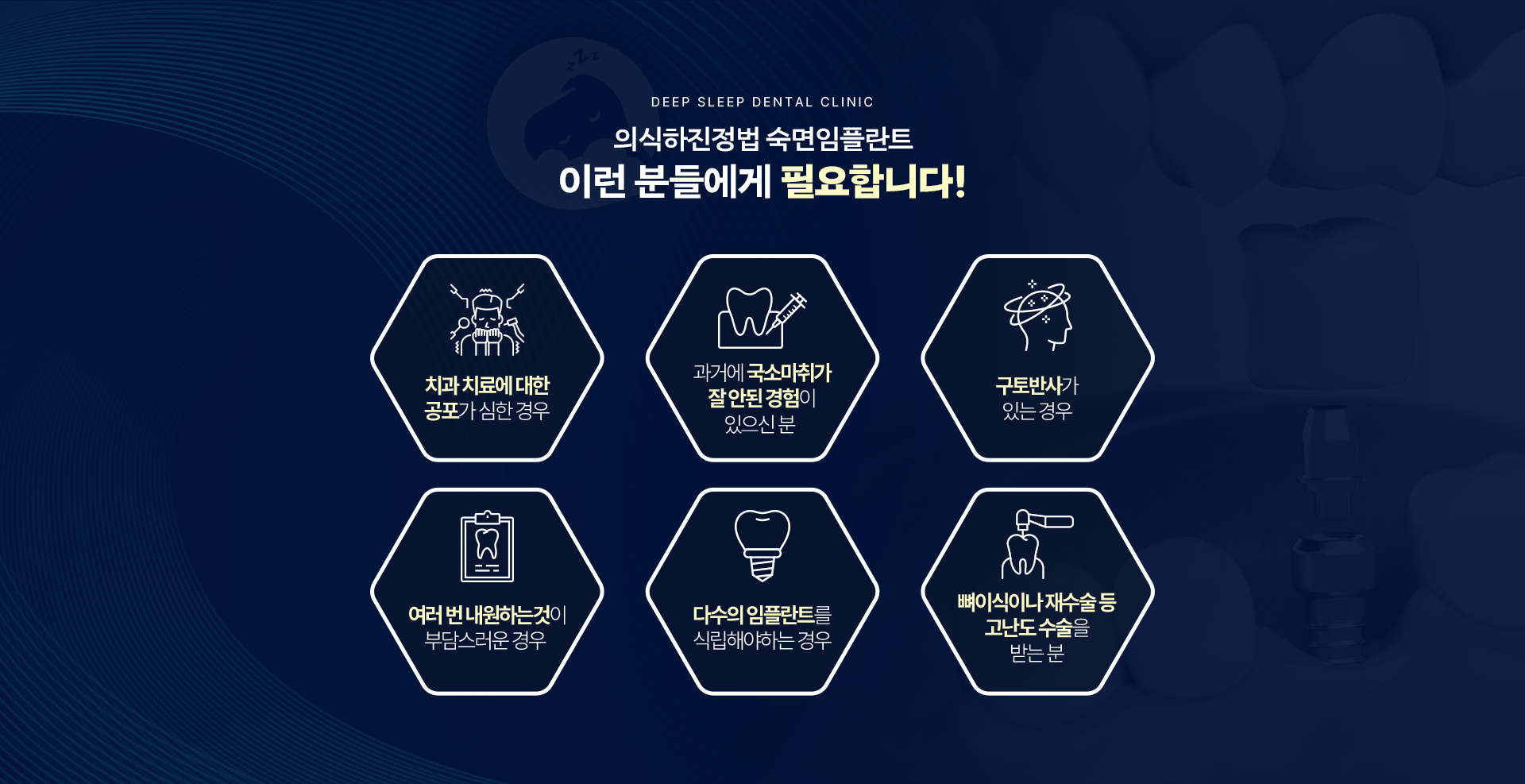 의식하진정법 숙면임플란트 이런 분들에게 필요합니다! 치과치료에 대한 공포가 심하신 경우, 과거에 국소마취가 잘 안된 경험이 있으신 분, 구토반사가 있는 분, 여러 번 내원하는것이 부담스러운 분, 다수의 임플란트를 식립해야하는 분, 뼈이식이나 재수술 등 고난도 수술을 받는 분