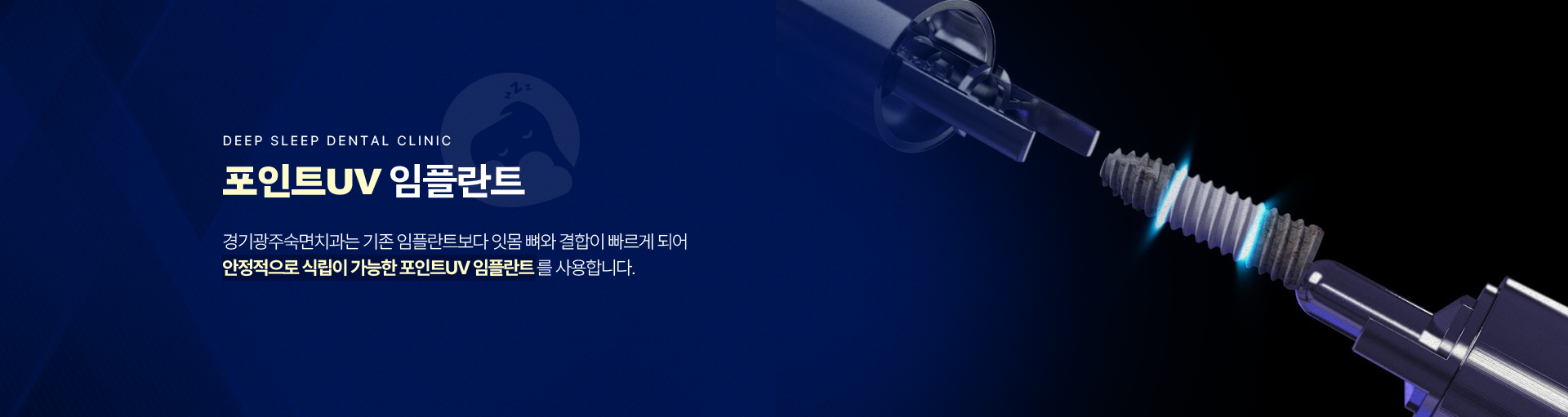 포인트UV 임플란트-경기광주숙면치과는 기존 임플란트보다 잇몸 뼈와 결합이 빠르게 되어 안정적으로 식립이 가능한 포인트UV 임플란트를 사용합니다.