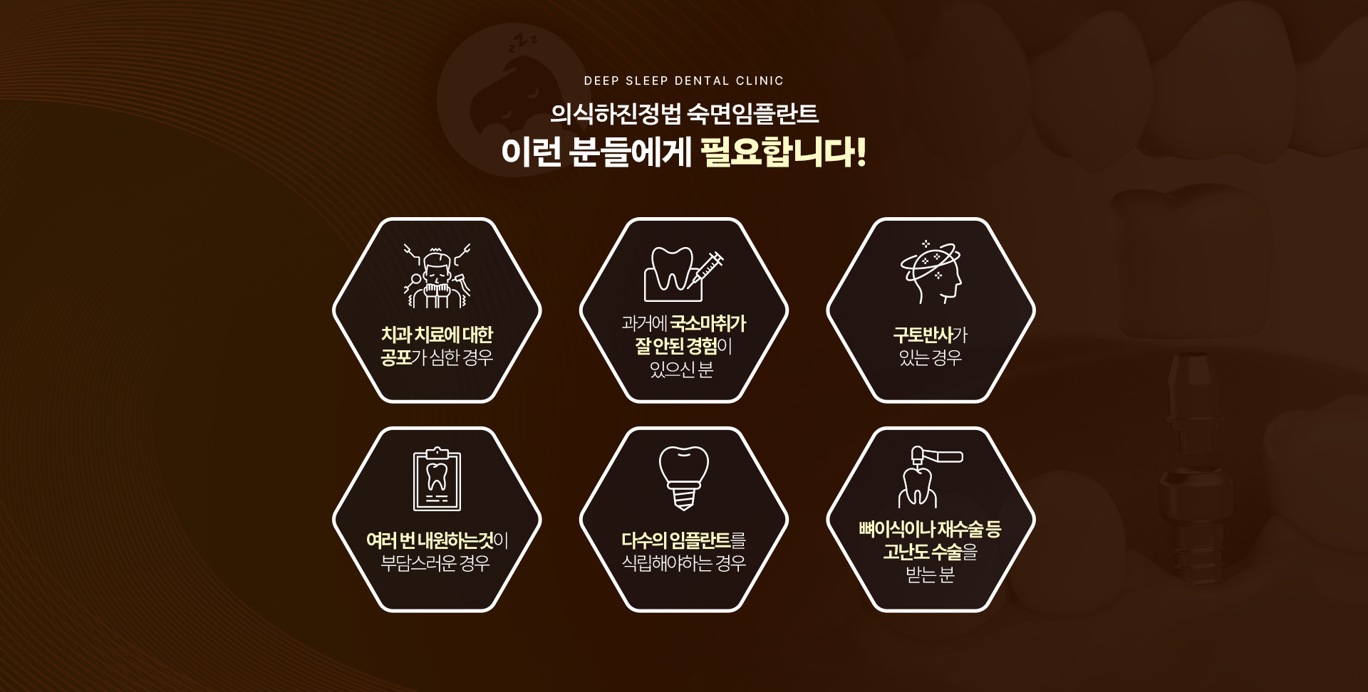 의식하진정법 숙면임플란트 이런 분들에게 필요합니다! 치과치료에 대한 공포가 심하신 경우, 과거에 국소마취가 잘 안된 경험이 있으신 분, 구토반사가 있는 분, 여러 번 내원하는것이 부담스러운 분, 다수의 임플란트를 식립해야하는 분, 뼈이식이나 재수술 등 고난도 수술을 받는 분