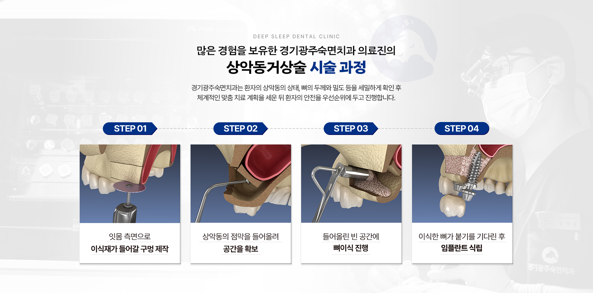 많은 경험을 보유한 경기광주숙면치과 의료진의 상악동거상술 시술 과정