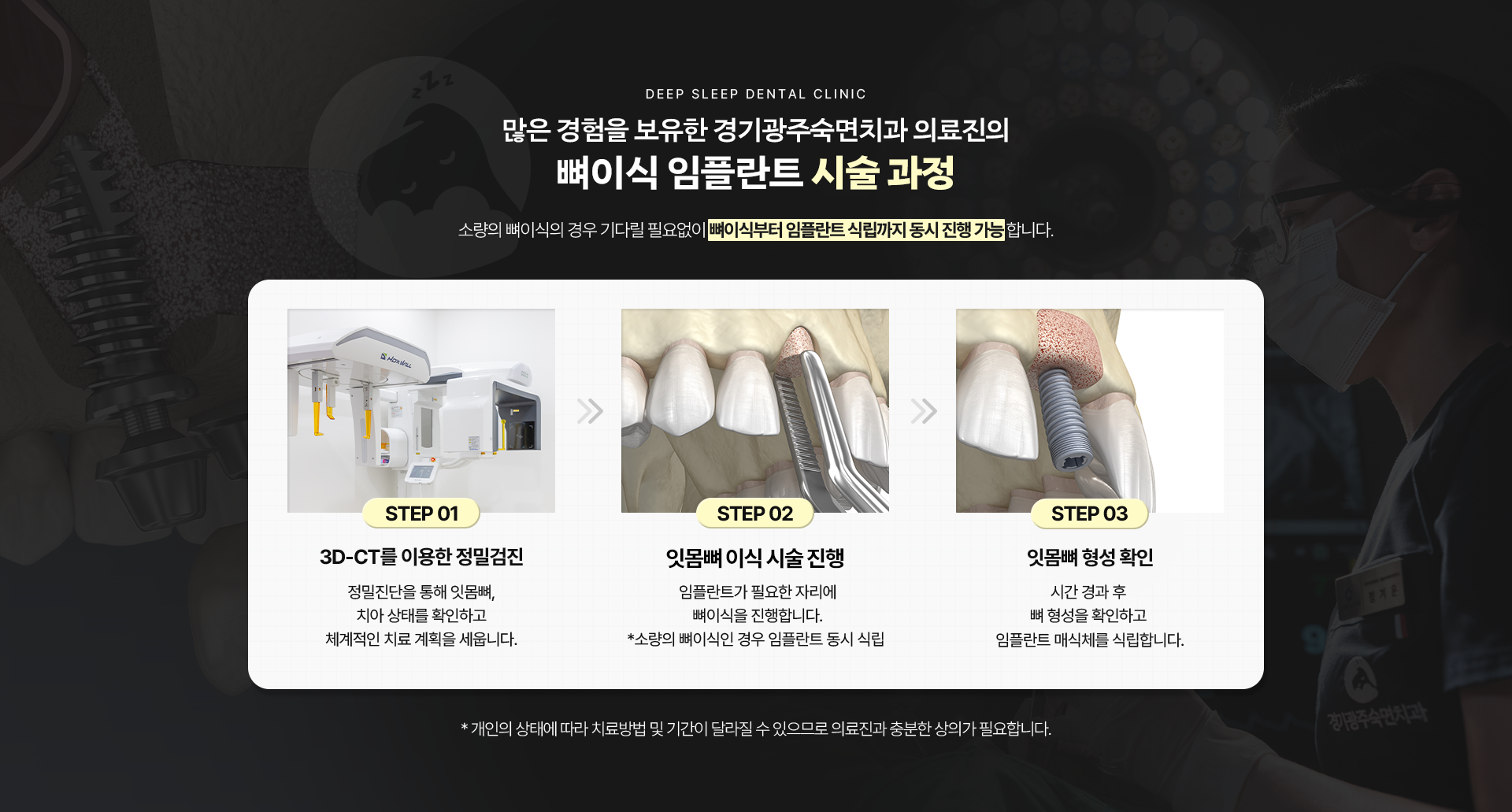 많은 경험을 보유한 경기광주숙면치과 의료진의 뼈이식 임플란트 시술 과정-STEP 01. 3D-CT를 이용한 정밀검진, STEP 02. 잇몸뼈 이식 시술 진행, STEP 03.잇몸뼈 형성 확인