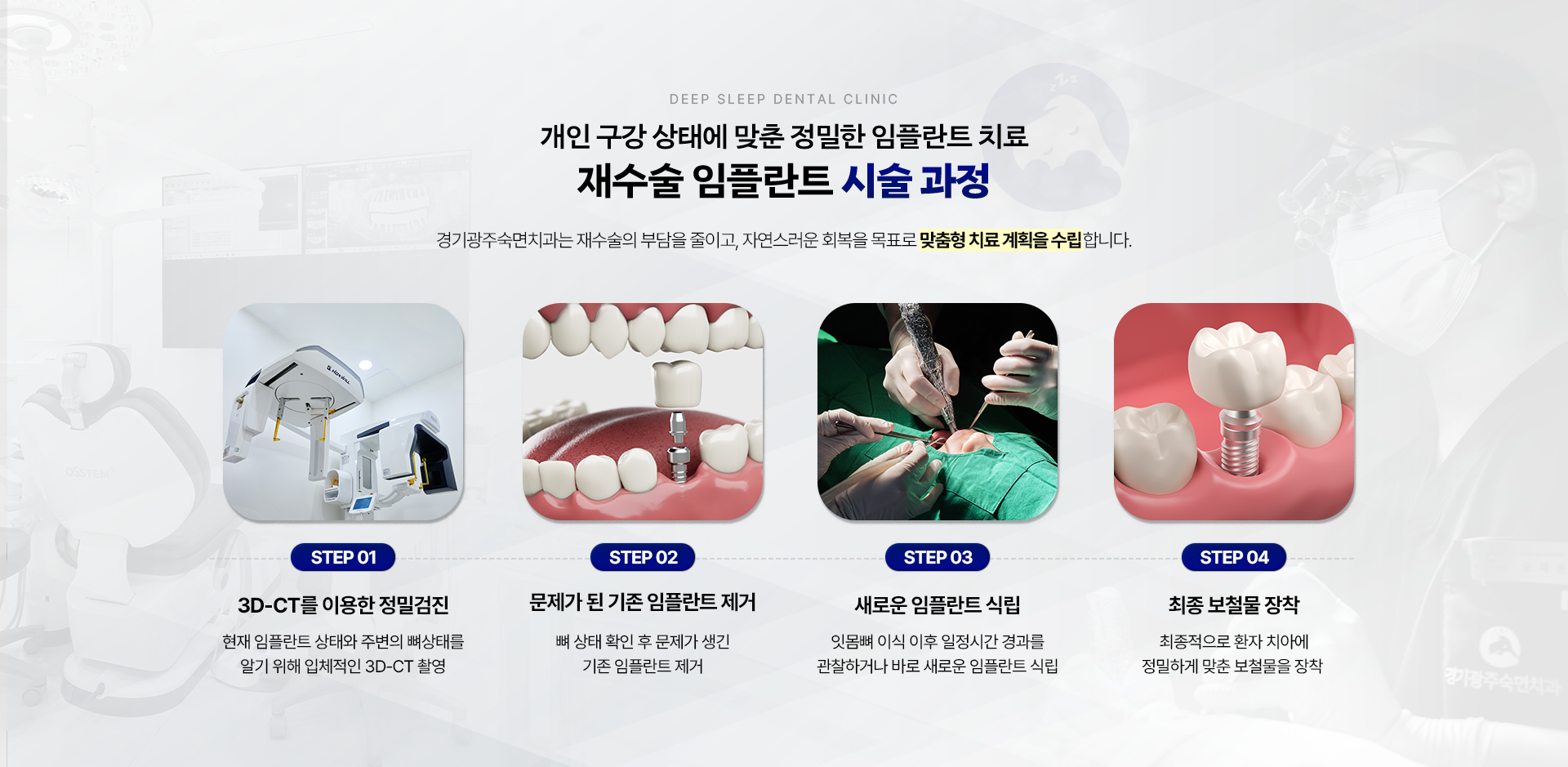 개인 구강 상태에 맞춘 정밀한 임플란트 치료 재수술 임플란트 시술 과정