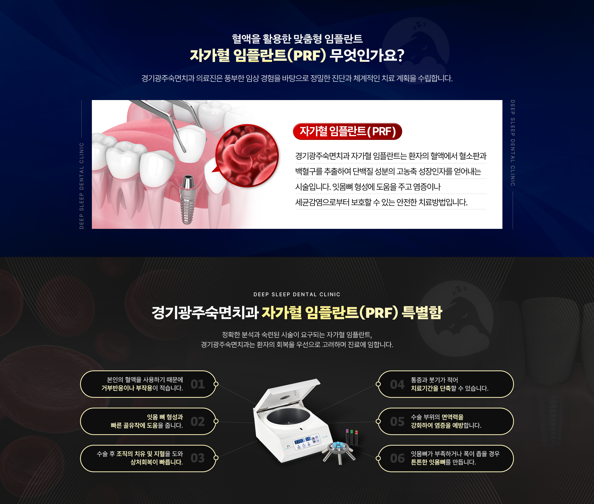 혈액을 활용한 맞춤형 임플란트 - 자가혈 임플란트(PRF) 무엇인가요?|경기광주숙면치과 자가혈 임플란트(PRF) 특별함