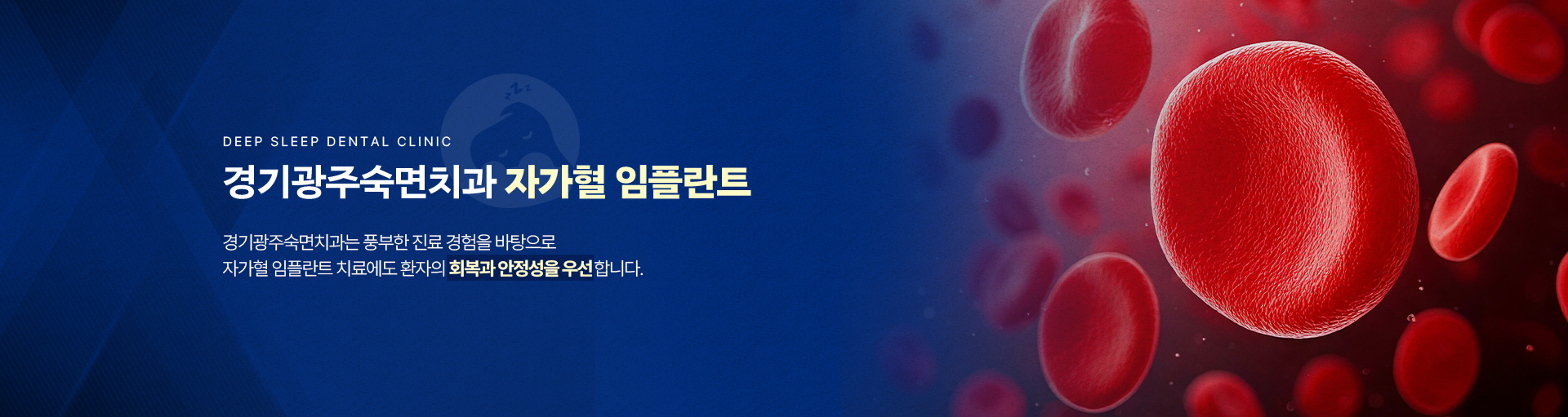 경기광주숙면치과 자가혈 임플란트-경기광주숙면치과는 풍부한 진료 경험을 바탕으로 자가혈 임플란트 치료에도 환자의 회복과 안정성을 우선합니다.