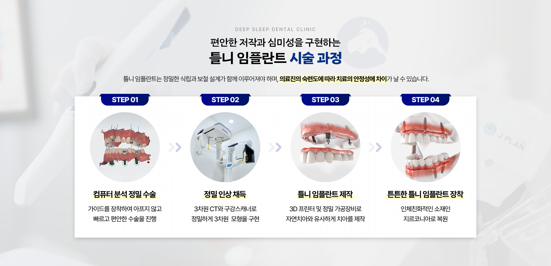 편안한 저작과 심미성을 구현하는 틀니 임플란트 시술 과정-STEP 01.컴퓨터 분석 정밀 수술, STEP 02.정밀 인상 채득, STEP 03.틀니 임플란트 제작, STEP 04.튼튼한 틀니 임플란트 장착