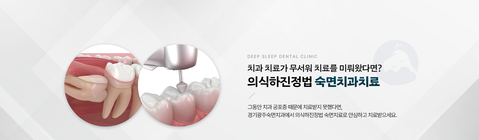 치과 치료가 무서워 치료를 미뤄왔다면? 의식하진정법 숙면치과치료