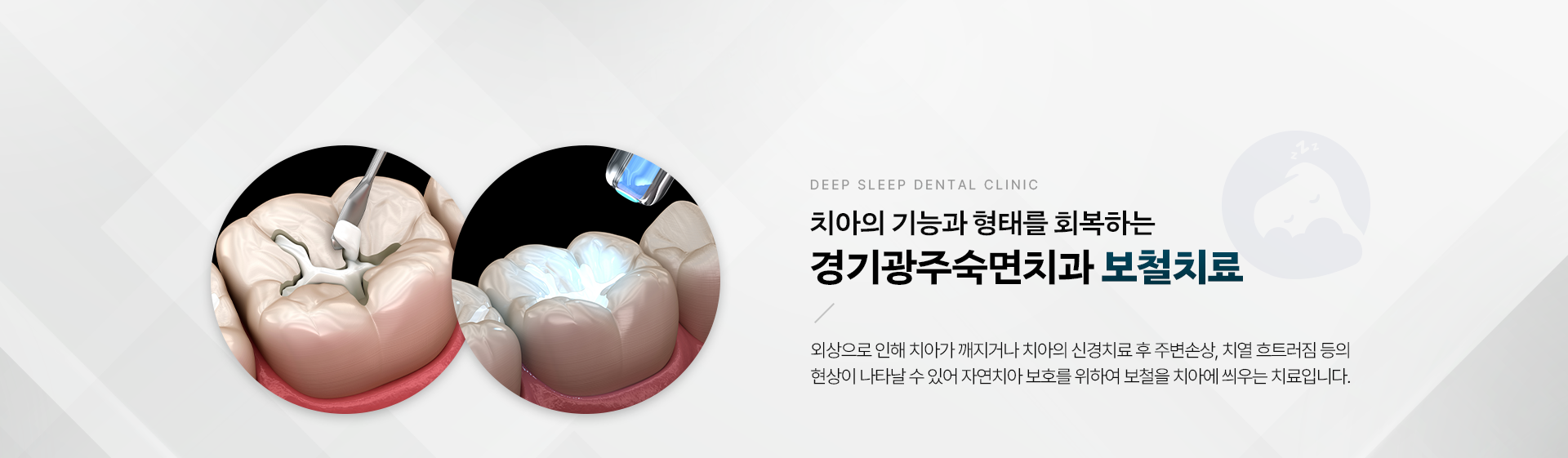 치아의 기능과 형태를 회복하는 경기광주숙면치과 보철치료