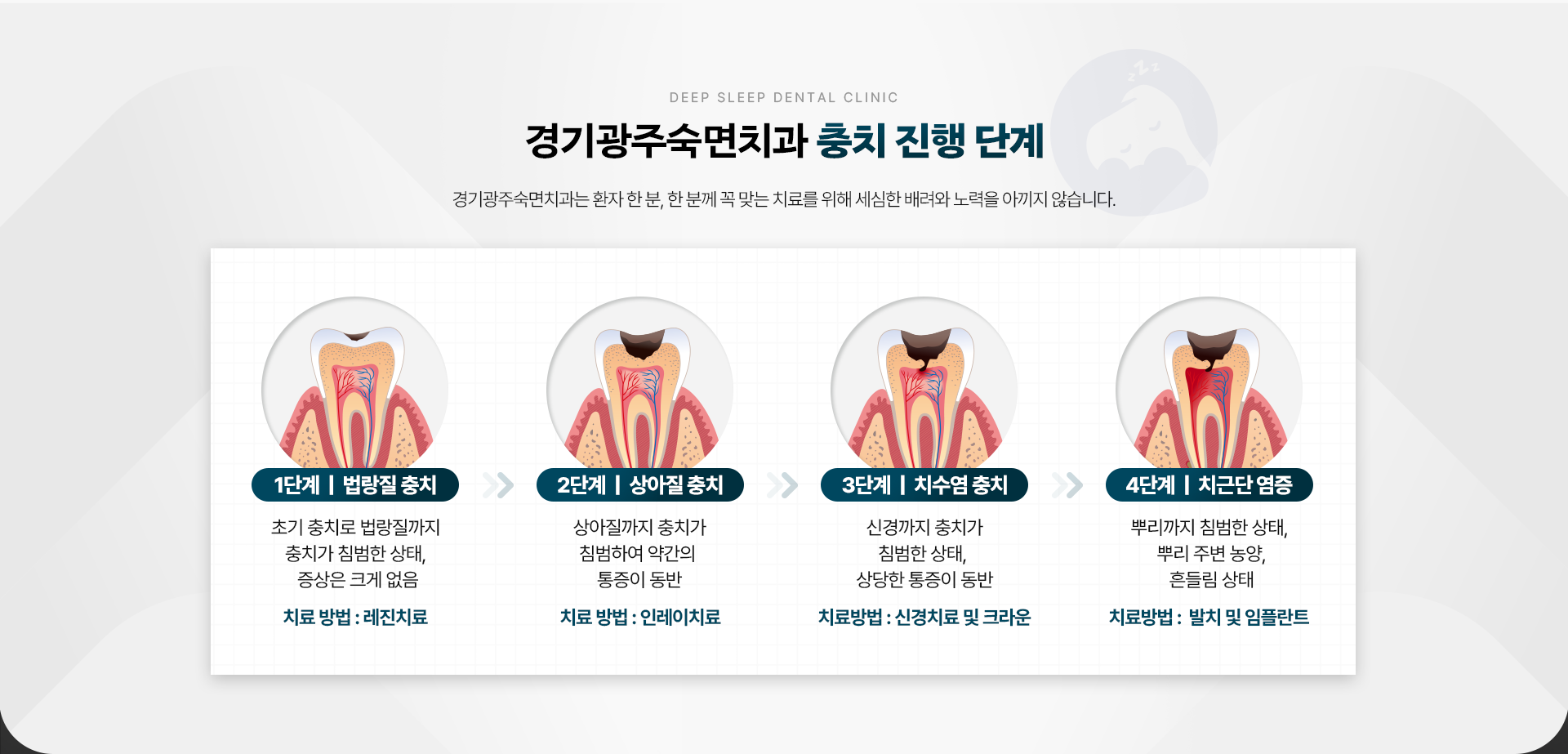 경기광주숙면치과 충치 진행 단계