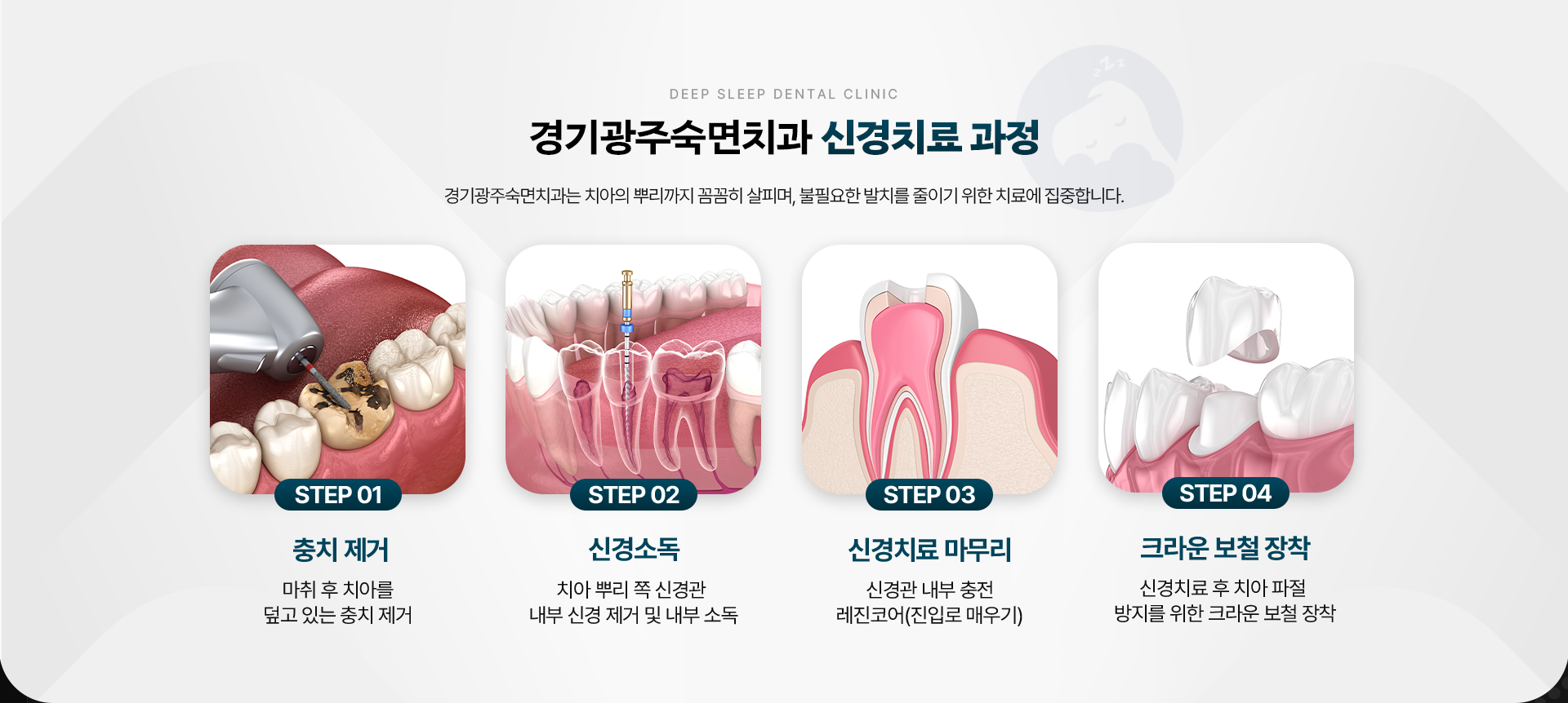 경기광주숙면치과 신경치료 과정