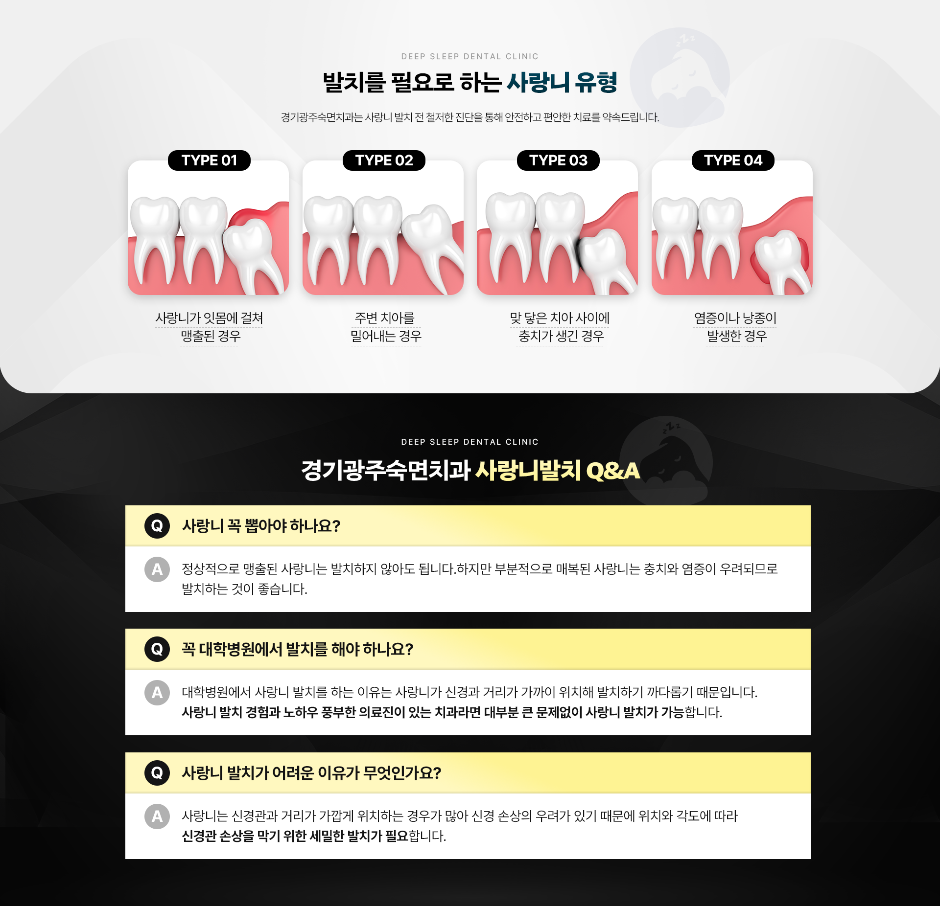 발치를 필요로 하는 사랑니 유형|경기광주숙면치과 사랑니발치 Q&A