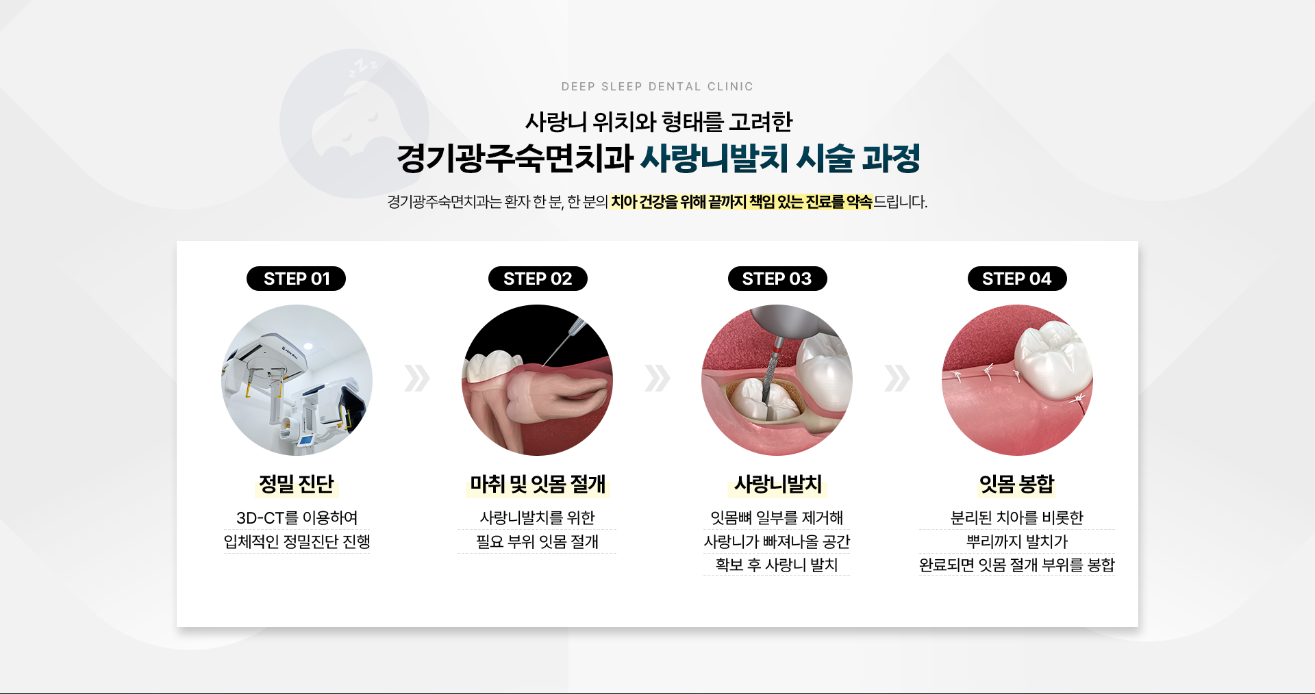 사랑니 위치와 형태를 고려한 경기광주숙면치과 사랑니발치 시술 과정