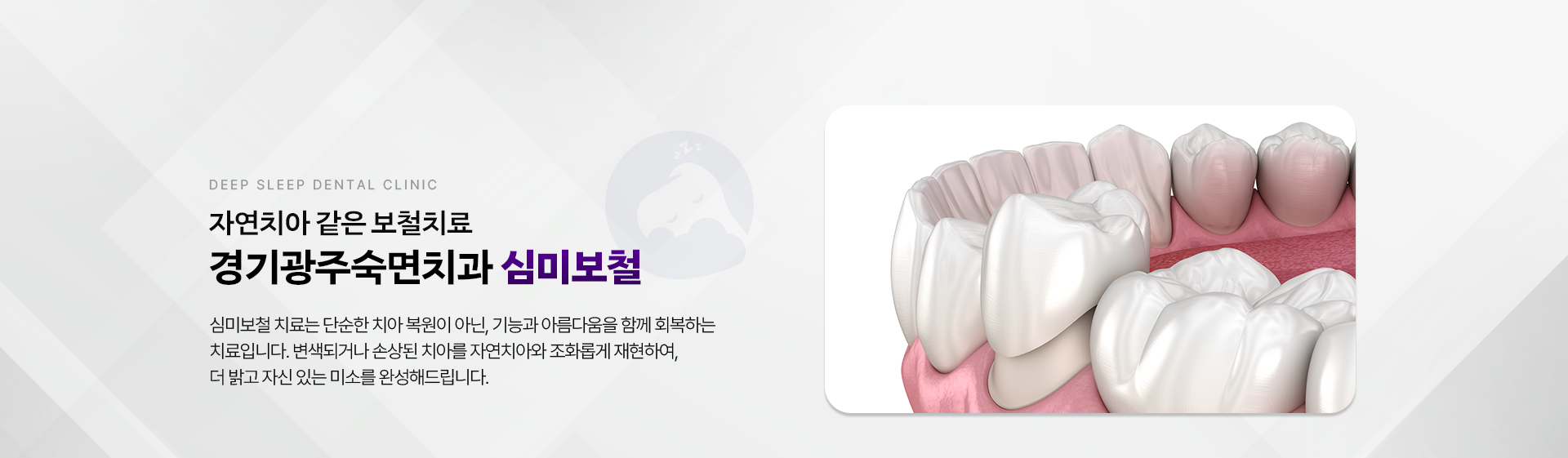 자연치아 같은 보철치료 경기광주숙면치과 심미보철