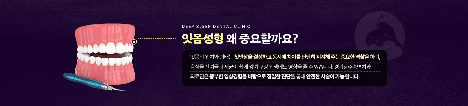 잇몸성형 왜 중요할까요?