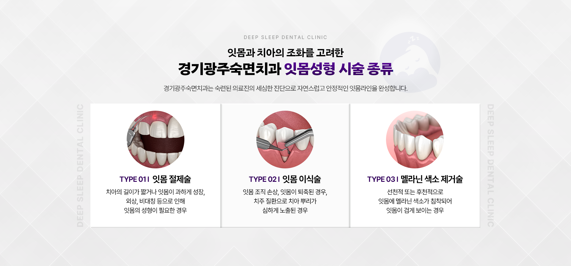 잇몸과 치아의 조화를 고려한 경기광주숙면치과 잇몸성형 시술 종류-TYPE 01.잇몸 절제술, TYPE 02.잇몸 이식술, TYPE 03.멜라닌 색소 제거술