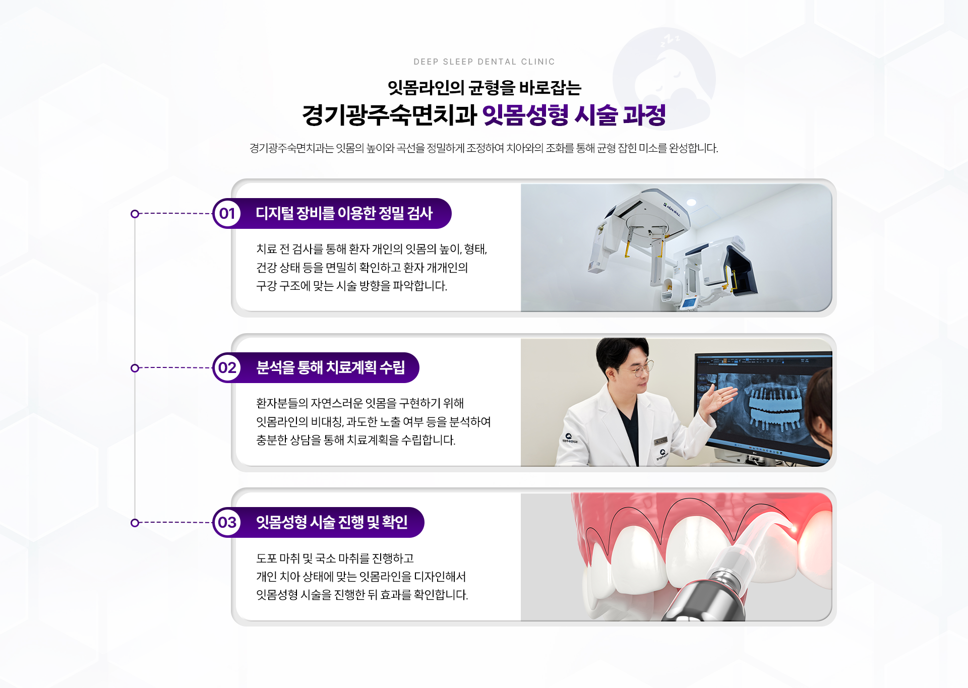 잇몸라인의 균형을 바로잡는 경기광주숙면치과 잇몸성형 시술 과정-01.디지털 장비를 이용한 정밀 검사, 02.분석을 통해 치료계획 수립, 03.잇몸성형 시술 진행 및 확인