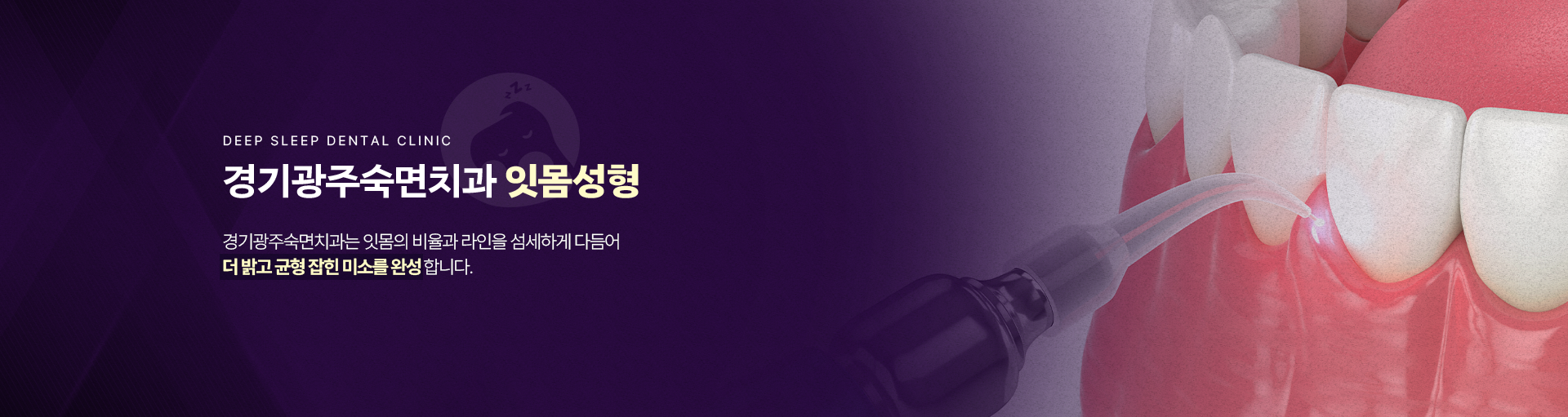 경기광주숙면치과 잇몸성형-경기광주숙면치과는 잇몸의 비율과 라인을 섬세하게 다듬어 더 밝고 균형 잡힌 미소를 완성합니다.
