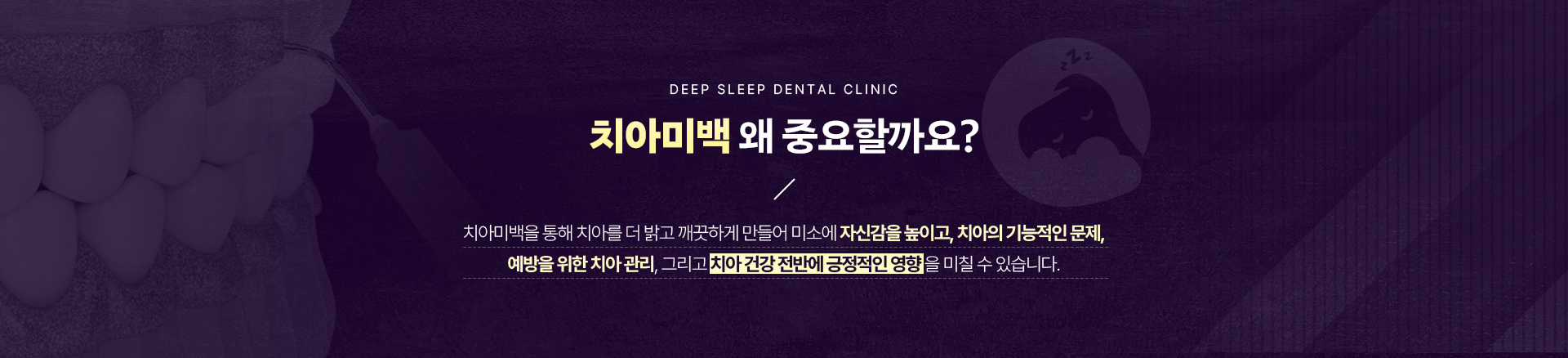 치아미백 왜 중요할까요?