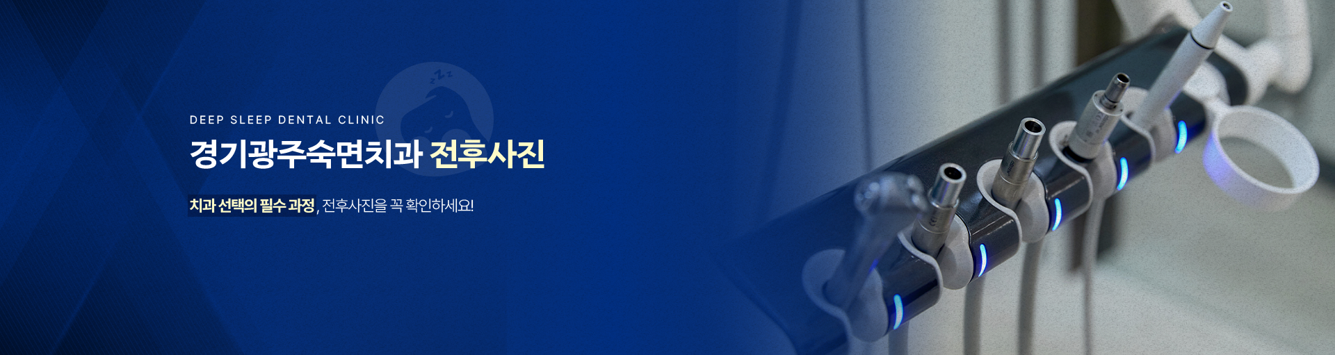 경기광주숙면치과 전후사진-치과 선택의 필수 과정, 전후사진을 꼭 확인하세요!