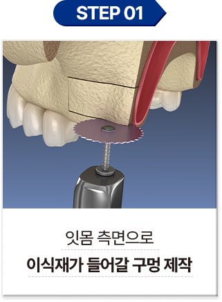 step 01