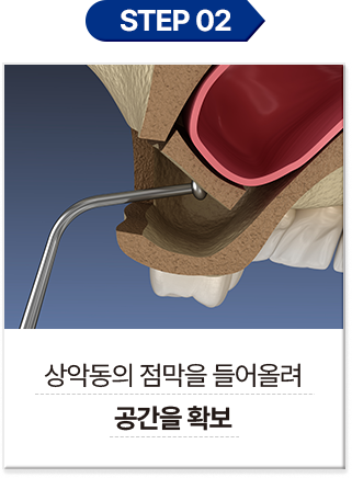 step 02