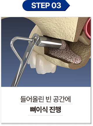 step 03