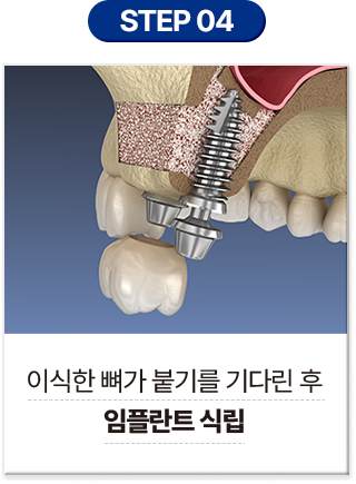 step 04