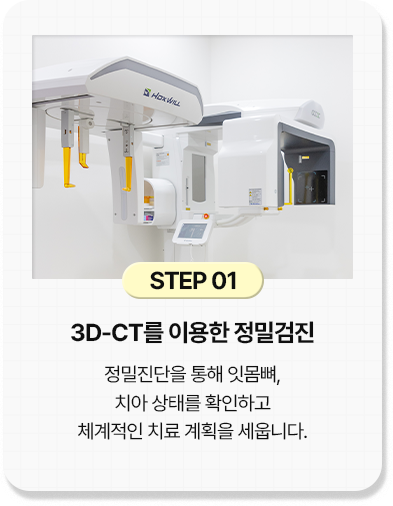 step 01
