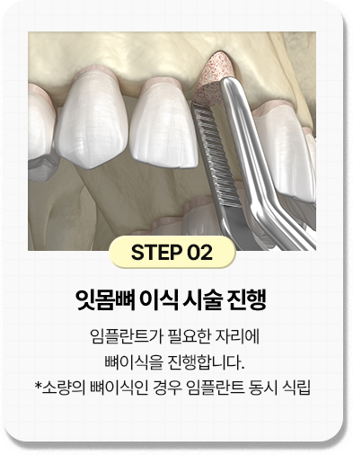 step 02