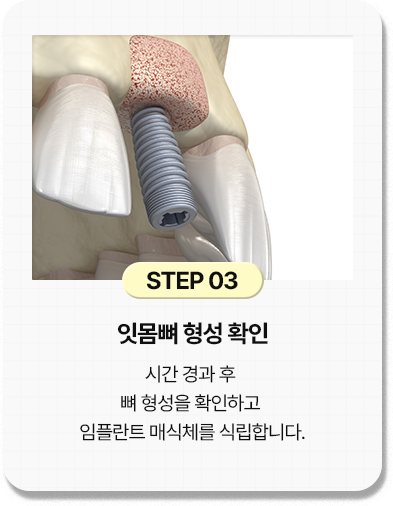 step 03