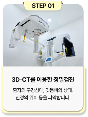 step 01
