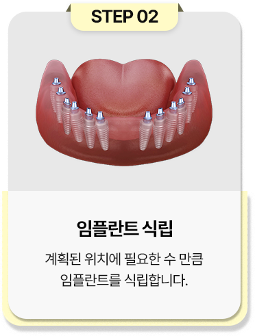 step 02