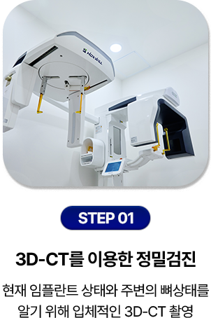 step 01