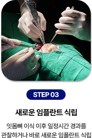 step 03