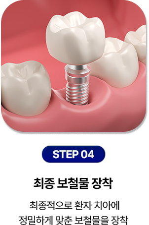 step 03