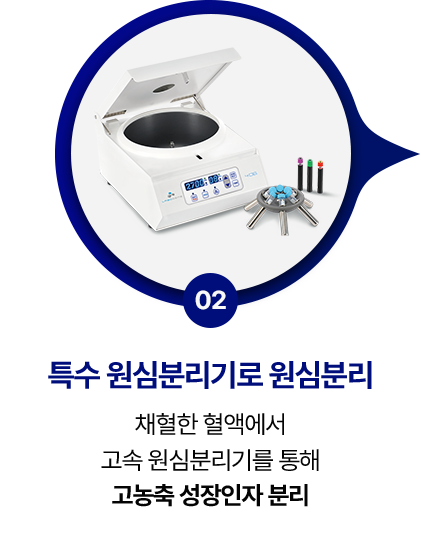 step 02