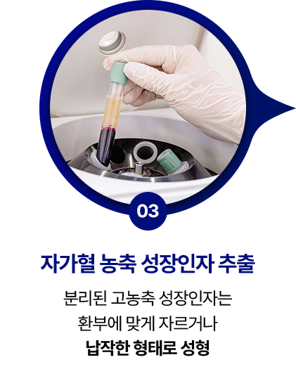 step 03