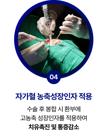 step 04