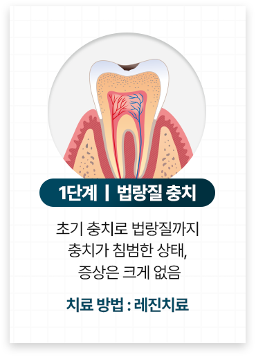 레진치료