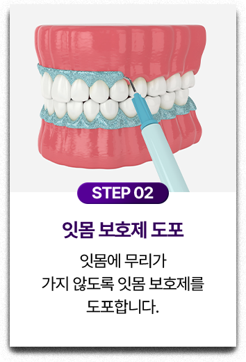 STEP 02.잇몸 보호제 도포