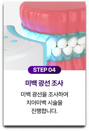 STEP 04.미백 광선 조사