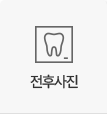전후사진