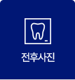 잔후사진