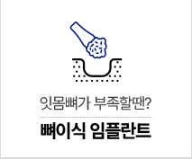 뼈이식 임플란트