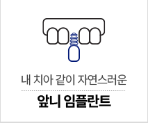 앞니 임플란트