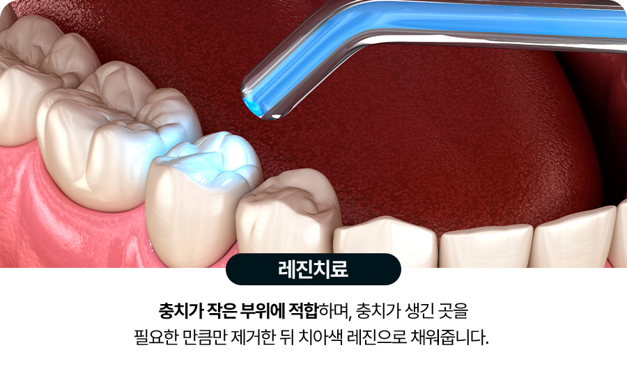 레진