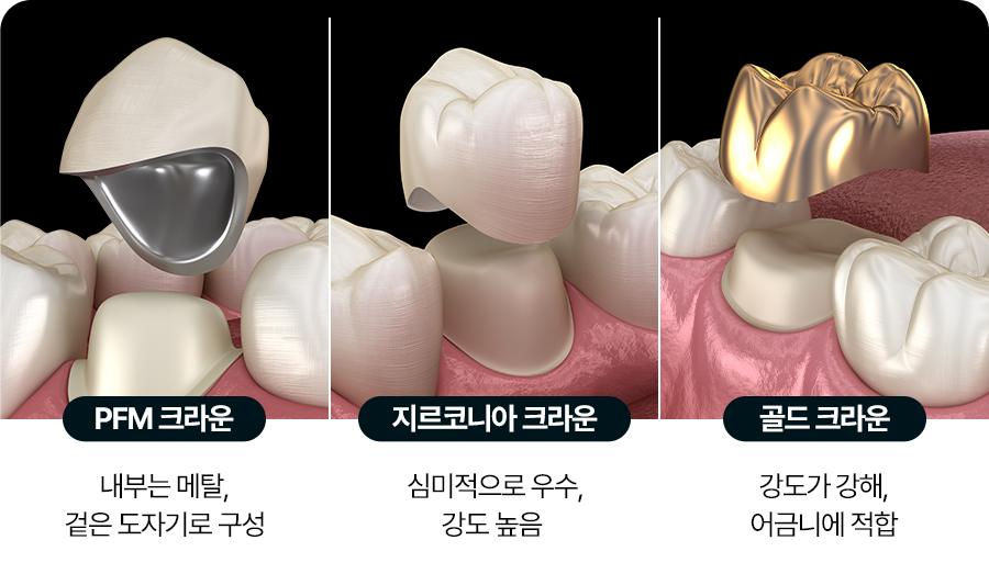 크라운