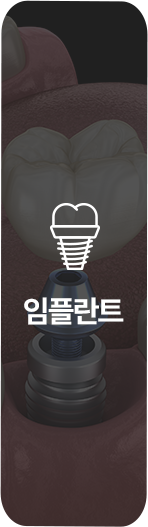 임플란트